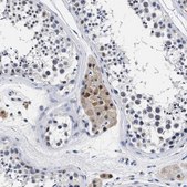 Anti-PRPF4B antibody produced in rabbit Prestige Antibodies® Powered by Atlas Antibodies, affinity isolated antibody, buffered aqueous glycerol solution