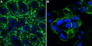 Anti-Vimentin Antibody, clone V9 clone V9, Chemicon®, from mouse