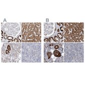 Anti-PCCB antibody produced in rabbit Prestige Antibodies® Powered by Atlas Antibodies, affinity isolated antibody, buffered aqueous glycerol solution