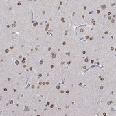 Anti-LRFN4 antibody produced in rabbit Prestige Antibodies® Powered by Atlas Antibodies, affinity isolated antibody, buffered aqueous glycerol solution