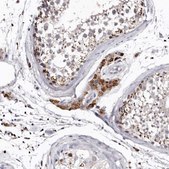 Anti-SLC10A4 antibody produced in rabbit Prestige Antibodies® Powered by Atlas Antibodies, affinity isolated antibody, buffered aqueous glycerol solution