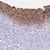 Anti-DHRS2 antibody produced in rabbit Prestige Antibodies® Powered by Atlas Antibodies, affinity isolated antibody, buffered aqueous glycerol solution