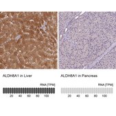 Anti-ALDH8A1 antibody produced in rabbit Prestige Antibodies® Powered by Atlas Antibodies, affinity isolated antibody, buffered aqueous glycerol solution