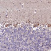 Anti-SLC26A6 antibody produced in rabbit Prestige Antibodies® Powered by Atlas Antibodies, affinity isolated antibody, buffered aqueous glycerol solution