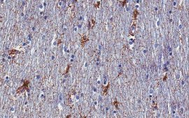 Anti-APC Antibody, CT, clone C-APC Antibody 28.9, Ascites Free clone C-APC 28.9, from mouse