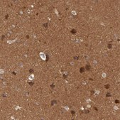 Anti-BRAF antibody produced in rabbit Prestige Antibodies® Powered by Atlas Antibodies, affinity isolated antibody, buffered aqueous glycerol solution
