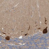 Anti-LRSAM1 antibody produced in rabbit Prestige Antibodies® Powered by Atlas Antibodies, affinity isolated antibody, buffered aqueous glycerol solution, Ab1
