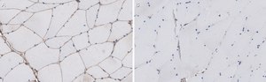 Anti-α-Dystroglycan Antibody, clone VIA4-1 ZooMAb® Mouse Monoclonal recombinant, expressed in HEK 293 cells
