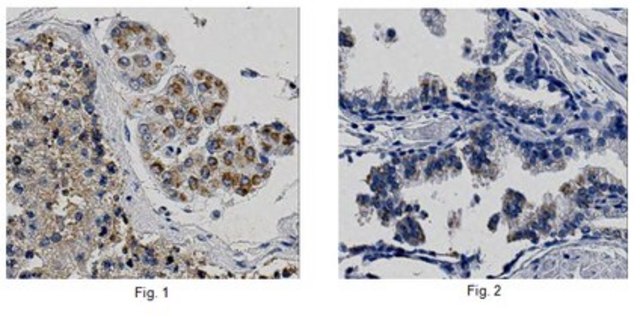 Anti-PATE1 Antibody from rabbit, purified by affinity chromatography