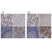 Anti-DBT antibody produced in rabbit Prestige Antibodies® Powered by Atlas Antibodies, affinity isolated antibody, buffered aqueous glycerol solution, Ab2