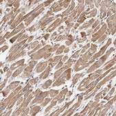 Anti-USP21 antibody produced in rabbit Prestige Antibodies® Powered by Atlas Antibodies, affinity isolated antibody, buffered aqueous glycerol solution