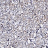 Anti-ERBB2 antibody produced in rabbit Ab1, Prestige Antibodies® Powered by Atlas Antibodies, affinity isolated antibody, buffered aqueous glycerol solution