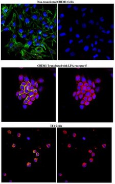 Anti-LPA receptor 5 Antibody (GPR92) from rabbit, purified by affinity chromatography