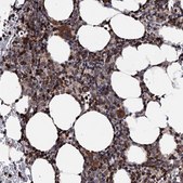 Anti-FGFR1OP2 antibody produced in rabbit Prestige Antibodies® Powered by Atlas Antibodies, affinity isolated antibody, buffered aqueous glycerol solution
