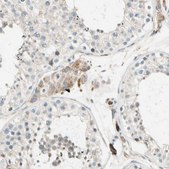 Anti-LPCAT2 antibody produced in rabbit Prestige Antibodies® Powered by Atlas Antibodies, affinity isolated antibody, buffered aqueous glycerol solution