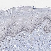 Anti-KMT2D antibody produced in rabbit Prestige Antibodies® Powered by Atlas Antibodies, affinity isolated antibody, buffered aqueous glycerol solution