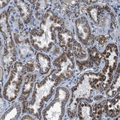 Anti-OGDH antibody produced in rabbit Prestige Antibodies® Powered by Atlas Antibodies, affinity isolated antibody, buffered aqueous glycerol solution
