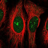 Anti-ZNF106 antibody produced in rabbit Prestige Antibodies® Powered by Atlas Antibodies, affinity isolated antibody, buffered aqueous glycerol solution
