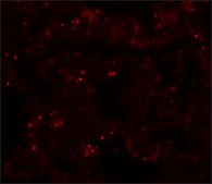 Anti-PLEKHM1 antibody produced in rabbit affinity isolated antibody, buffered aqueous solution