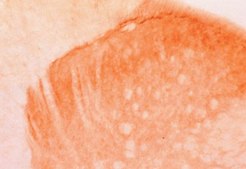 Anti-Vanilloid Receptor Like Protein 1 Antibody, pain, CT serum, Chemicon®