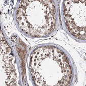 Anti-DNAJC27 antibody produced in rabbit Prestige Antibodies® Powered by Atlas Antibodies, affinity isolated antibody, buffered aqueous glycerol solution