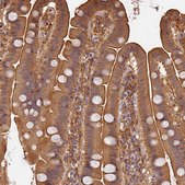 Anti-ARHGAP17 antibody produced in rabbit Prestige Antibodies® Powered by Atlas Antibodies, affinity isolated antibody, buffered aqueous glycerol solution