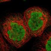 Anti-TIAM2 antibody produced in rabbit Prestige Antibodies® Powered by Atlas Antibodies, affinity isolated antibody, buffered aqueous glycerol solution
