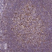 Anti-TOMM40 antibody produced in rabbit Prestige Antibodies® Powered by Atlas Antibodies, affinity isolated antibody, buffered aqueous glycerol solution