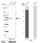 Anti-ETV6 antibody produced in rabbit Prestige Antibodies® Powered by Atlas Antibodies, affinity isolated antibody, buffered aqueous glycerol solution
