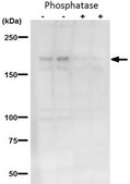 Anti-phospho BRD4 (Ser492) from rabbit