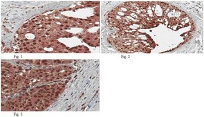 Anti-BRCA1 Antibody, clone MS13 clone MS13, from mouse