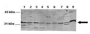 Anti-NFKBIB antibody produced in rabbit affinity isolated antibody