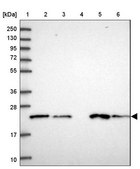 Anti-COMMD2 antibody produced in rabbit Prestige Antibodies® Powered by Atlas Antibodies, affinity isolated antibody, buffered aqueous glycerol solution