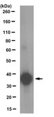 Anti-R-Spondin 2 Antibody, clone 14C7.1 clone 14C7.1, from mouse
