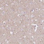 Anti-CADM4 antibody produced in rabbit affinity isolated antibody, buffered aqueous glycerol solution