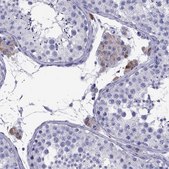 Anti-TTLL13P antibody produced in rabbit Prestige Antibodies® Powered by Atlas Antibodies, affinity isolated antibody, buffered aqueous glycerol solution