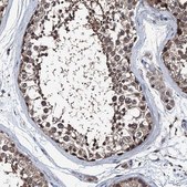 Anti-PSMD13 antibody produced in rabbit Prestige Antibodies® Powered by Atlas Antibodies, affinity isolated antibody, buffered aqueous glycerol solution