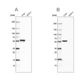 Anti-PCCB antibody produced in rabbit Prestige Antibodies® Powered by Atlas Antibodies, affinity isolated antibody, buffered aqueous glycerol solution