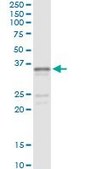 Monoclonal Anti-SGCG, (C-terminal) antibody produced in mouse clone 3C5, purified immunoglobulin, buffered aqueous solution