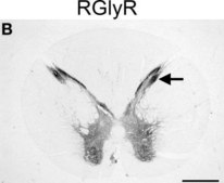 Anti-Glycine Receptor Antibody Chemicon®, from rabbit