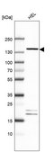 Anti-GPR158 antibody produced in rabbit Prestige Antibodies® Powered by Atlas Antibodies, affinity isolated antibody, buffered aqueous glycerol solution
