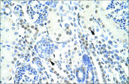 Anti-POGZ antibody produced in rabbit IgG fraction of antiserum