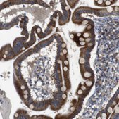 Anti-CHST10 antibody produced in rabbit Prestige Antibodies® Powered by Atlas Antibodies, affinity isolated antibody, buffered aqueous glycerol solution