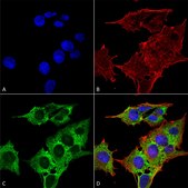 Monoclonal Anti-Clcn3 - Fitc antibody produced in mouse clone S258-5, purified immunoglobulin