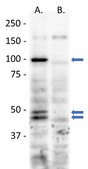 Anti-iRhom1 Antibody, clone RHF1A 20A8