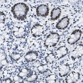 Anti-DACH1 antibody produced in rabbit Prestige Antibodies® Powered by Atlas Antibodies, affinity isolated antibody, buffered aqueous glycerol solution
