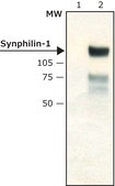 Anti-Synphilin-1 antibody produced in rabbit ~2 mg/mL, affinity isolated antibody, buffered aqueous solution