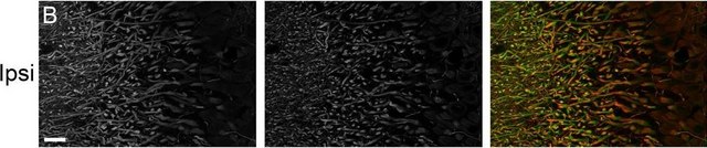 Anti-PDE4B2 Antibody from rabbit, purified by affinity chromatography