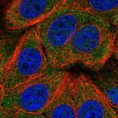 Anti-TIGAR antibody produced in rabbit Prestige Antibodies® Powered by Atlas Antibodies, affinity isolated antibody, buffered aqueous glycerol solution