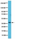 Anti-PP1β Antibody Upstate®, from rabbit